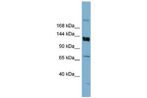WB Suggested Anti-ABCB4  Antibody Titration: 0. (ABCB4 抗体  (Middle Region))
