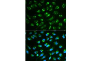 Immunofluorescence analysis of MCF7 cell using IL7 antibody. (IL-7 抗体  (AA 26-177))