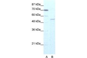 Western Blotting (WB) image for anti-Zinc Finger Protein 665 (ZNF665) antibody (ABIN2461274) (ZNF665 抗体)
