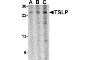 Western blot analysis of TSLP in A-20 cell lysate with AP30965PU-N TSLP antibody at 0. (Thymic Stromal Lymphopoietin 抗体  (Center))