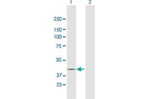 Western Blotting (WB) image for anti-Regulatory Associated Protein of mTOR, Complex 1 (RPTOR) (AA 1-379) antibody (ABIN1327629)