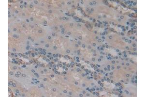 IHC-P analysis of Human Kidney Tissue, with DAB staining. (IGFBP6 抗体  (AA 31-240))