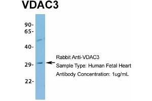 Western Blotting (WB) image for anti-Voltage-Dependent Anion Channel 3 (VDAC3) (N-Term) antibody (ABIN2776182)