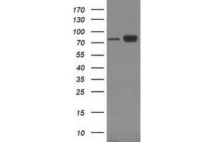 Image no. 5 for anti-Catenin (Cadherin-Associated Protein), beta 1, 88kDa (CTNNB1) antibody (ABIN1496890) (CTNNB1 抗体)