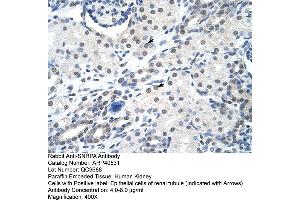 Rabbit Anti-SNRPA Antibody  Paraffin Embedded Tissue: Human Kidney Cellular Data: Epithelial cells of renal tubule Antibody Concentration: 4. (SNRPA1 抗体  (Middle Region))