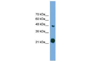 WB Suggested Anti-RAB37 Antibody Titration: 0. (RAB37 抗体  (Middle Region))