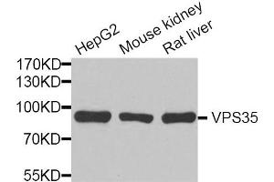 Western blot analysis of extracts of various cell lines, using VPS35 antibody. (VPS35 抗体)
