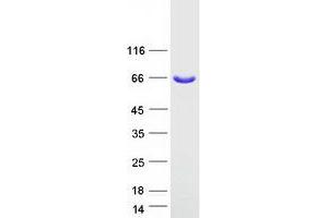 Western Blotting (WB) image for Kelch Repeat and BTB (POZ) Domain Containing 5 (KBTBD5) protein (Myc-DYKDDDDK Tag) (ABIN2723998)