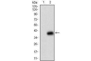 Fig. (beta-2 Microglobulin 抗体  (AA 21-100))