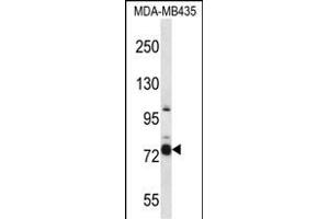 CASS4 Antibody (C-term) (ABIN657438 and ABIN2846469) western blot analysis in MDA-M cell line lysates (35 μg/lane).