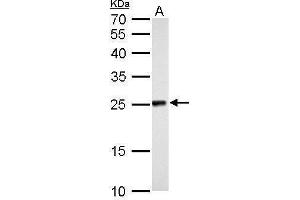 WB Image NDUFV2 antibody detects NDUFV2 protein by Western blot analysis. (NDUFV2 抗体  (Center))