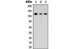 Western blot analysis of CNK2 expression in HEK293T (A), mouse Brain (B), rat brain (C) whole cell lysates.