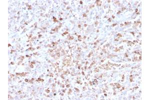 Formalin-fixed, paraffin-embedded human spleen stained with Lambda Light Chain Recombinant Rabbit Monoclonal Antibody (LLC/3778R). (Recombinant IgL 抗体)