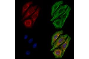 ABIN6261181 and ABIN6278835 staining Hela cells by IF/ICC. (COX3 抗体  (Internal Region))
