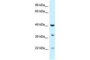 Image no. 1 for anti-Galactokinase 1 (GALK1) (AA 219-268) antibody (ABIN6747604)