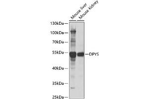 Western blot analysis of extracts of various cell lines, using DPYS antibody (ABIN6127809, ABIN6139809, ABIN6139810 and ABIN6221986) at 1:1000 dilution.