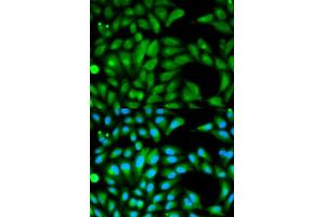 Immunofluorescence analysis of HeLa cells using PARK2 antibody (ABIN5970356). (Parkin 抗体)