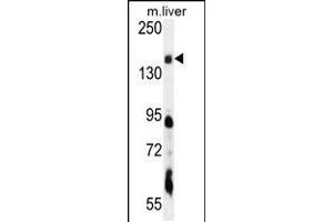 Western blot analysis in mouse liver tissue lysates (35ug/lane). (PIK3C2A 抗体  (C-Term))
