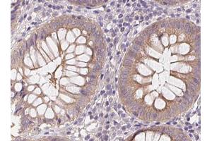 Phospho-AMPK alpha (Thr172) Antibody for IHC in human colon. (AMPK alpha 抗体  (pThr172))