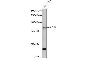 Western blot analysis of extracts of Rat brain, using NOS1 antibody (ABIN6129512, ABIN6144725, ABIN6144726 and ABIN6216548) at 1:500 dilution. (NOS1 抗体  (AA 1-180))