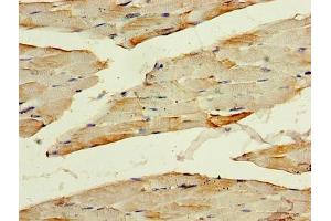 Immunohistochemistry of paraffin-embedded human skeletal muscle tissue using ABIN7142079 at dilution of 1:100 (PHPT1 抗体  (AA 1-125))