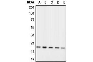 Western blot analysis of RPL10 expression in MCF7 (A), Jurkat (B), K562 (C), Raw264. (RPL10 抗体  (Center))