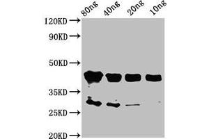 Western Blot Positive WB detected in Recombinant protein All lanes: olig2 antibody at 2 μg/mL Secondary Goat polyclonal to rabbit IgG at 1/50000 dilution Predicted band size: 44 kDa Observed band size: 44 kDa