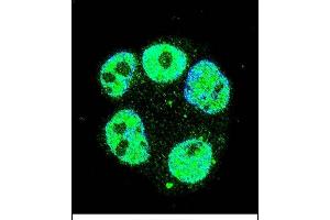 Confocal immunofluorescent analysis of METTL2 Antibody (C-term) (ABIN655892 and ABIN2845293) with ZR-75-1 cell followed by Alexa Fluor 488-conjugated goat anti-rabbit lgG (green). (METTL2 抗体  (C-Term))