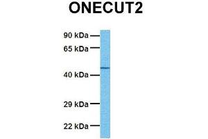Host:  Rabbit  Target Name:  ONECUT2  Sample Tissue:  Human OVCAR-3  Antibody Dilution:  1. (ONECUT2 抗体  (Middle Region))