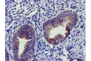 Immunohistochemical staining of paraffin-embedded Human endometrium tissue using anti-SOCS3 mouse monoclonal antibody. (SOCS3 抗体)