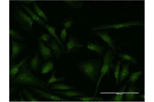 Immunofluorescence of monoclonal antibody to EIF4G2 on HeLa cell.