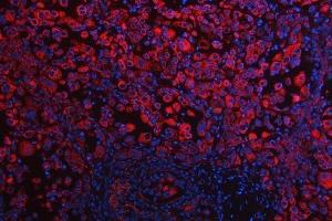 IF analysis of RPS5 using anti-RPS5 antibody (ABIN7599076).