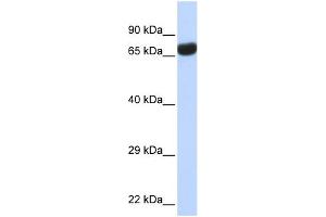 WB Suggested Anti-TPTE Antibody Titration:  0. (TPTE 抗体  (Middle Region))