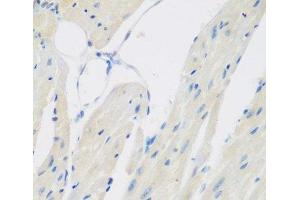 Immunohistochemistry of paraffin-embedded Mouse heart using CCL26 Polyclonal Antibody at dilution of 1:200 (40x lens). (CCL26 抗体)