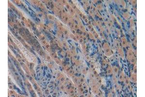 Figure. (CYR61 抗体  (AA 176-379))