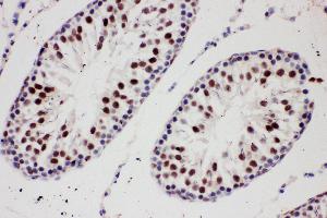 Immunohistochemistry (IHC) image for anti-Protein Inhibitor of Activated STAT, 1 (PIAS1) (AA 636-651), (C-Term) antibody (ABIN3044474)