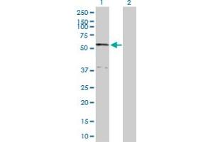 Western Blot analysis of SERPINA10 expression in transfected 293T cell line by SERPINA10 MaxPab polyclonal antibody. (SERPINA10 抗体  (AA 1-444))