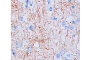 IHC-P analysis of Human Tissue, with DAB staining. (JAG1 抗体  (AA 33-250))