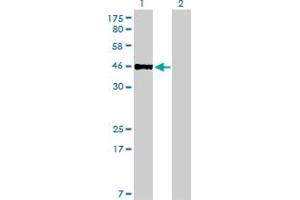 Western Blot analysis of PBX2 expression in transfected 293T cell line by PBX2 monoclonal antibody (M01), clone 2E9. (PBX2 抗体  (AA 354-430))