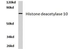 Image no. 2 for anti-Histone Deacetylase 10 (HDAC10) antibody (ABIN265454) (HDAC10 抗体)
