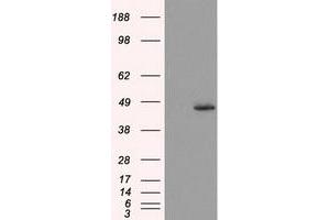 Western Blotting (WB) image for anti-Mitochondrial Translational Release Factor 1-Like (MTRF1L) antibody (ABIN1498696) (MTRF1L 抗体)