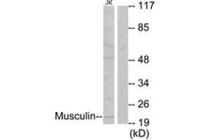 Western blot analysis of extracts from Jurkat cells, using Musculin Antibody. (Musculin 抗体  (AA 131-180))