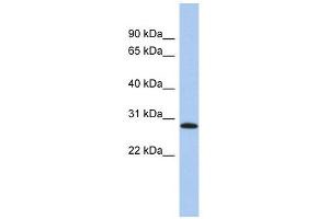 LYSMD1 antibody used at 1 ug/ml to detect target protein. (LYSMD1 抗体  (N-Term))