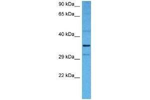 Host:  Rabbit  Target Name:  NFKBIB  Sample Tissue:  Mouse Liver  Antibody Dilution:  1ug/ml (NFKBIB 抗体  (N-Term))