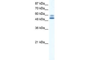 WB Suggested Anti-JMJD2D Antibody Titration:  5. (JMJD2D 抗体  (C-Term))