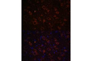 Immunofluorescence (IF) image for anti-Solute Carrier Family 6 (Neurotransmitter Transporter, Dopamine), Member 3 (SLC6A3) (C-Term) antibody (ABIN7270474)