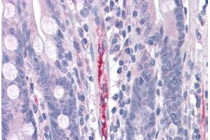 Human Small Intestine, Capillary: Formalin-Fixed, Paraffin-Embedded (FFPE) (FBLN3 抗体  (C-Term))
