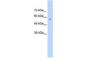 DDC antibody used at 5 ug/ml to detect target protein. (DDC 抗体)
