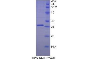 SDS-PAGE analysis of Chicken Transferrin Receptor Protein. (Transferrin Receptor 蛋白)