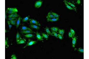 Immunofluorescent analysis of Hela cells using ABIN7149900 at dilution of 1:100 and Alexa Fluor 488-congugated AffiniPure Goat Anti-Rabbit IgG(H+L) (Dihydrofolate Reductase 抗体  (AA 2-187))